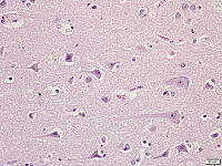 Betz細胞 [BAS110000001]