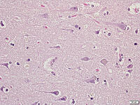 Betz細胞 [BAS110000002]