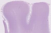 大脳皮質 [BAS110000003]