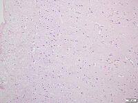 大脳皮質 [BAS110000006]