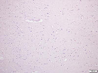 大脳皮質 [BAS110000007]