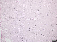 大脳皮質 [BAS110000008]