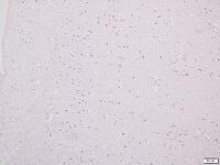 大脳皮質 [BAS110000009]