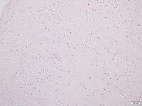 大脳皮質 [BAS110000010]