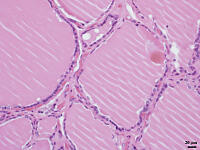 ヒトの甲状腺 [BAS110000011]