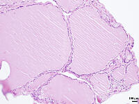 ヒトの甲状腺 [BAS110000012]