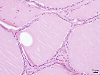 ヒトの甲状腺 [BAS110000014]