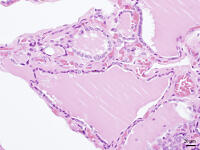 ヒトの甲状腺 [BAS110000015]