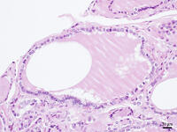 ヒトの甲状腺 [BAS110000016]