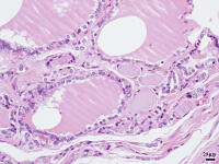 ヒトの甲状腺 [BAS110000017]