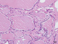 ヒトの甲状腺 [BAS110000018]