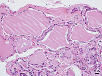 ヒトの甲状腺 [BAS110000019]