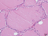 ヒトの甲状腺 [BAS110000020]