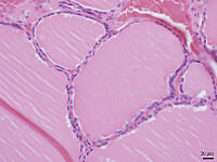 ヒトの甲状腺 [BAS110000021]