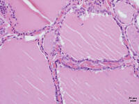 ヒトの甲状腺 [BAS110000022]