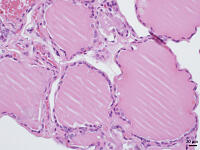 ヒトの甲状腺 [BAS110000023]