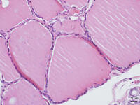 ヒトの甲状腺 [BAS110000024]