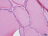 ヒトの甲状腺 [BAS110000025]