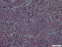 副腎皮質 [BAS110000047]