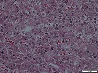 副腎皮質髄質 [BAS110000048]