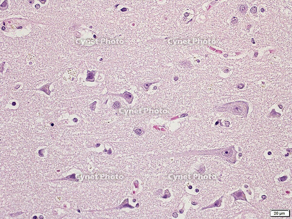 Betz細胞 [BAS110000001]