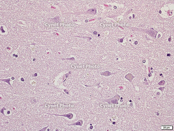 Betz細胞 [BAS110000002]