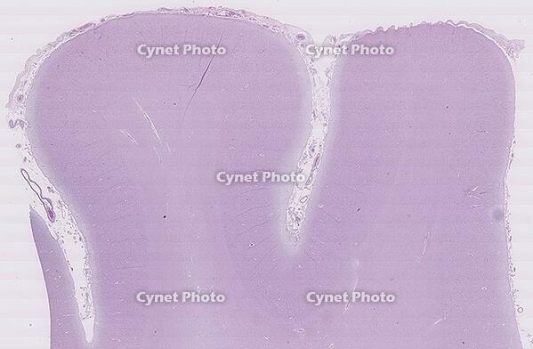 大脳皮質 [BAS110000003]