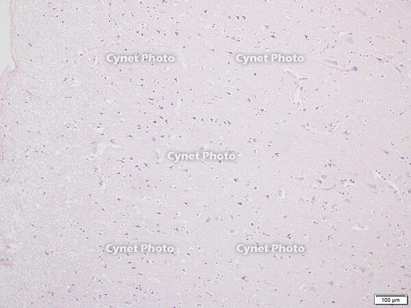 大脳皮質6層構造 [BAS110000005]