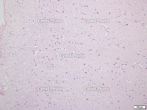 大脳皮質 [BAS110000006]