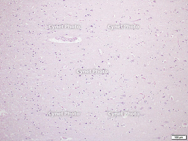 大脳皮質 [BAS110000007]