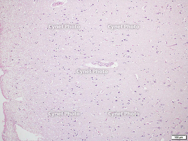 大脳皮質 [BAS110000008]