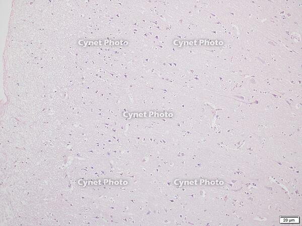 大脳皮質 [BAS110000009]