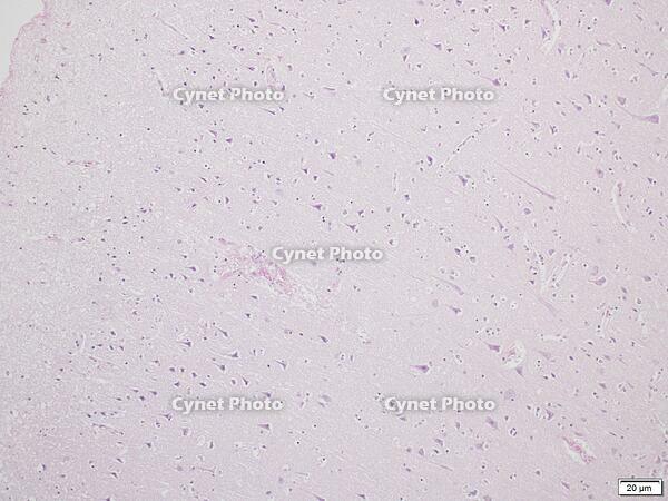 大脳皮質 [BAS110000010]