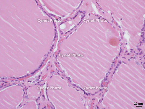 ヒトの甲状腺 [BAS110000011]