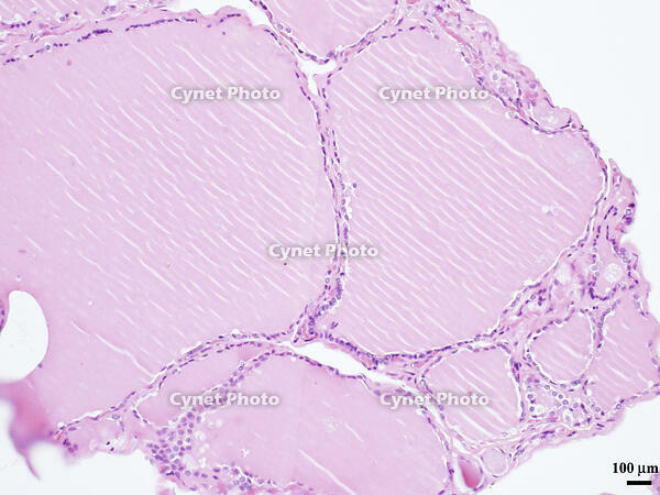 ヒトの甲状腺 [BAS110000012]