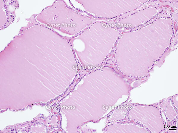 ヒトの甲状腺 [BAS110000013]