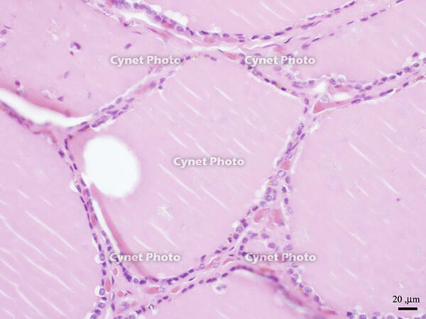 ヒトの甲状腺 [BAS110000014]