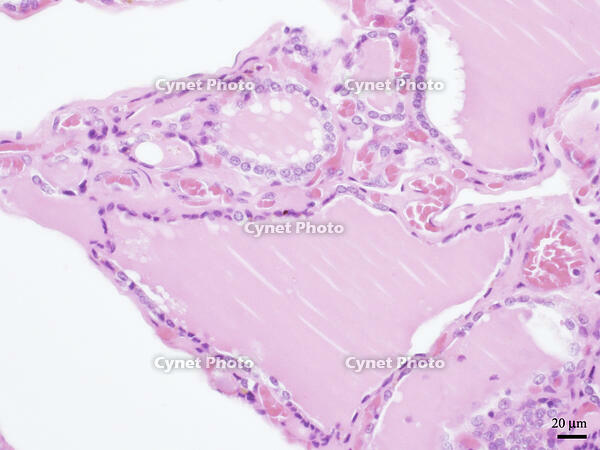 ヒトの甲状腺 [BAS110000015]