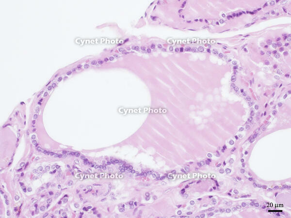 ヒトの甲状腺 [BAS110000016]
