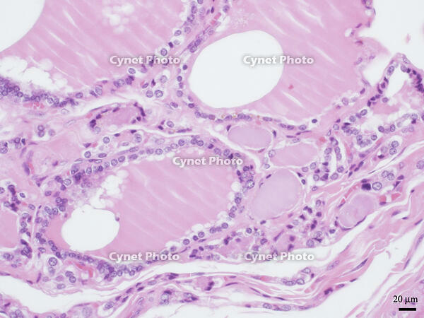 ヒトの甲状腺 [BAS110000017]