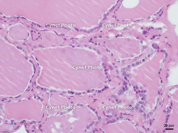 ヒトの甲状腺 [BAS110000018]