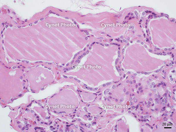 ヒトの甲状腺 [BAS110000019]