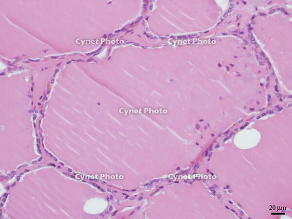 ヒトの甲状腺 [BAS110000020]