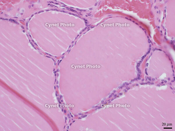 ヒトの甲状腺 [BAS110000021]