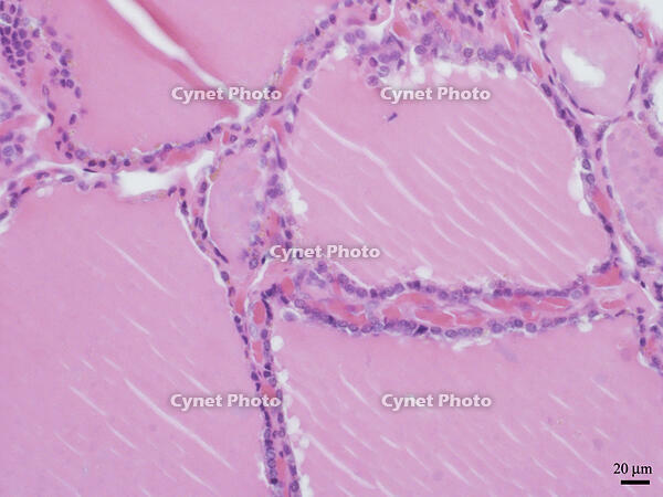 ヒトの甲状腺 [BAS110000022]