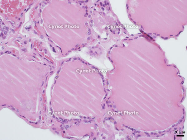ヒトの甲状腺 [BAS110000023]
