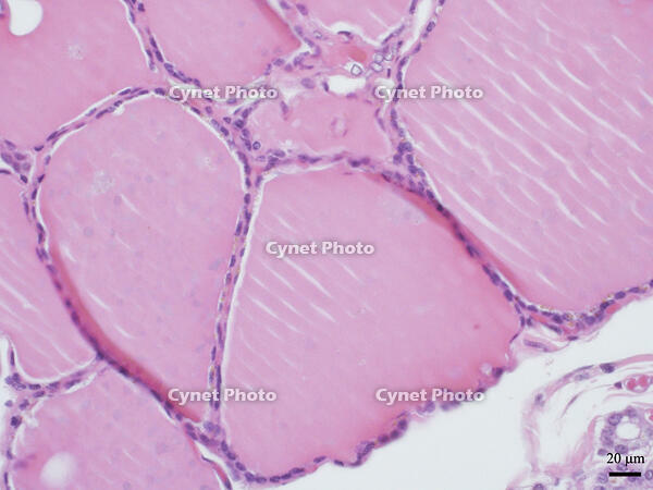 ヒトの甲状腺 [BAS110000024]