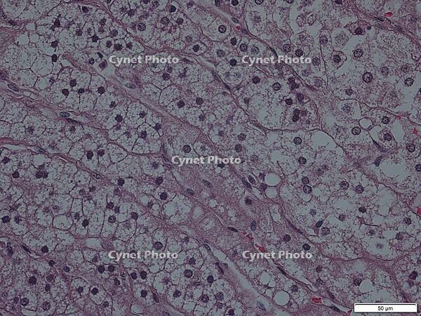 副腎皮質髄質 [BAS110000046]