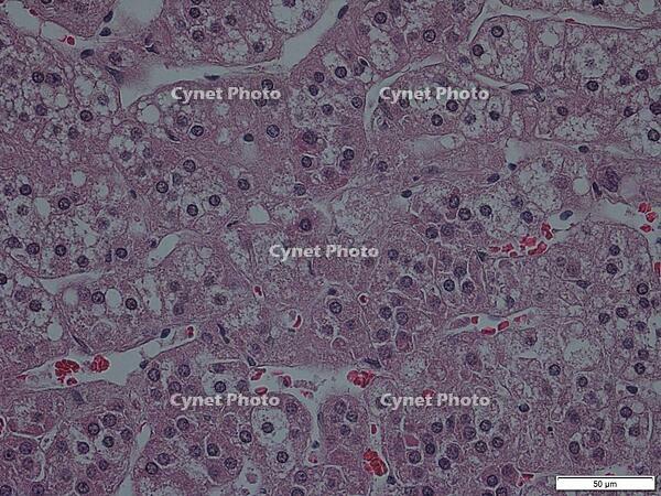 副腎皮質 [BAS110000047]