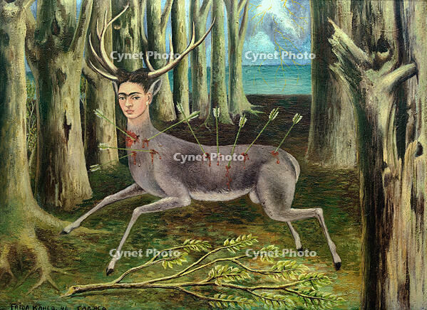 AKG107998 [AKG110392500]